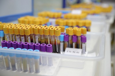 В г. Шахты ждут результатов анализов на ковид 734 человека