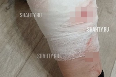 Стая бродячих собак искусала женщину в Шахтах