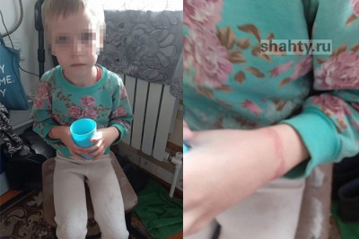 Под Шахтами девочку держали на привязи и истязали в Новошахтинске