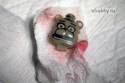 В Шахтах ветврачи спасли кота, проглотившего «скрепыша»