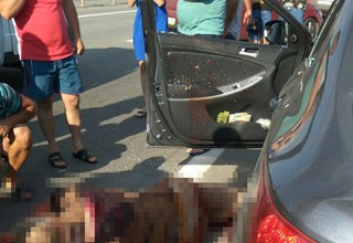 Ампутировали руку мужчине, в которого стрелял полицейский на трассе